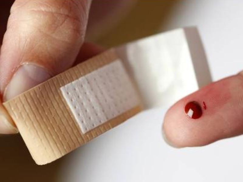  Blutende Wunden soll man mit Wasser auswaschen.
 

Bloß nicht! Das Deutsche Rote Kreuz warnt davor, denn auch Wasser ist keinesfalls steril. Besser ist, die Wunde keimfrei abzudecken, bis sich Schorf bildet. Denn sonst drohen Infektionen.
