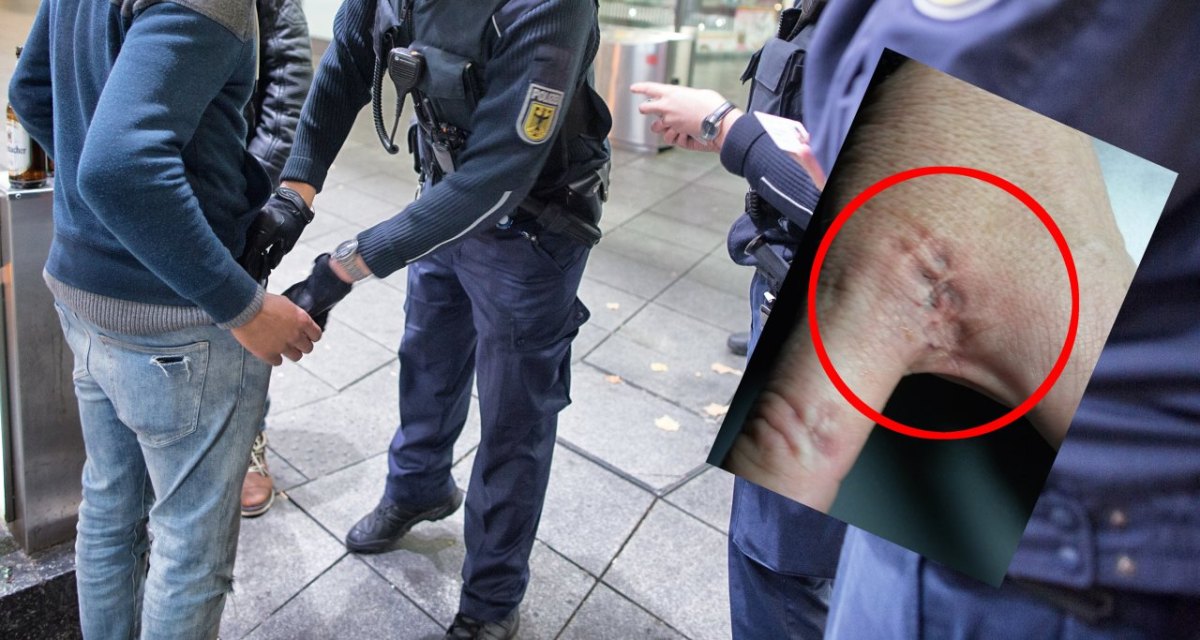 Bisswunde Hauptbahnhof Essen Bundespolizei.jpg