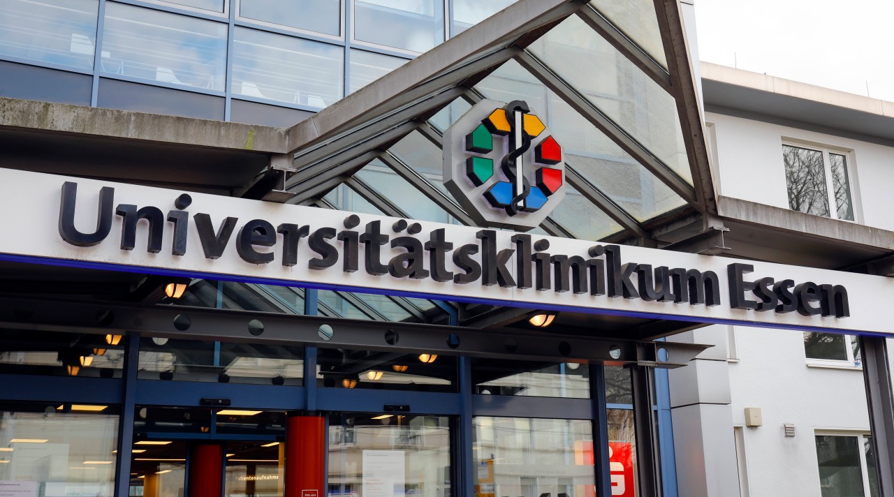 Im Universitätsklinikum in Essen ist nun der erste Fall von Affenpocken in Essen bekannt geworden. (Symbolbild)